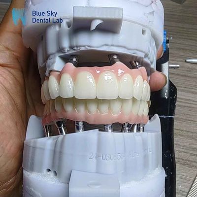 kopen Gelaagde Zirconia-implantaten Aanpassing Volledig boogimplantatkasten online manufacture
