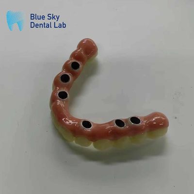 kopen Sterilisatie Stoomsterilisatie Implantaten met universele compatibiliteit online manufacture