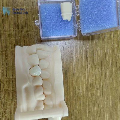 kopen Esthetische Zirconia Tandheelkundige herstelwerk Circonia Porseleinen kronen online manufacture