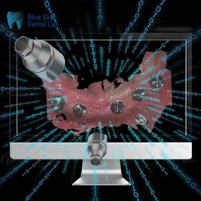 kopen Herbruikbare Implant Direct Scan Body All In One Tandheelkundige Scan Bodies online manufacture