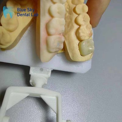 kopen Corrosiebestendige Zirconia kronen Natuurlijk uitziende Zirconia tanden online manufacture