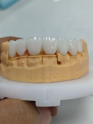 kopen 5 mm-6 mm gelaagde zirconia kronen Sterkte zirconia meerlaagse kroon online manufacture