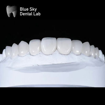 kopen Sleek Premium Veneer Cases 0,3 mm Ultra Thin Emax Veneers online manufacture