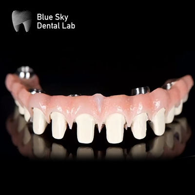kopen Aanpasbaar Pure Titanium Malo Bridge Tandheelkundig Blauw Sky Implantat Systeem online manufacture