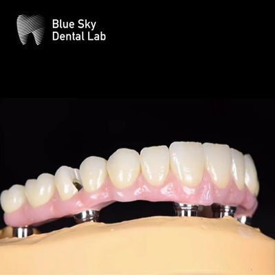 kopen Blue Sky Nature Tandheelkundige Implantat Hoesje Meerdere keuzes Implantat systeem online manufacture