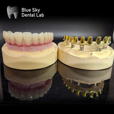 kopen Schroef vastgehouden MUA pilaren Implantatie Cases Zirconia kronen Meerschaal roze porselein met gemakkelijke reparatie online manufacture
