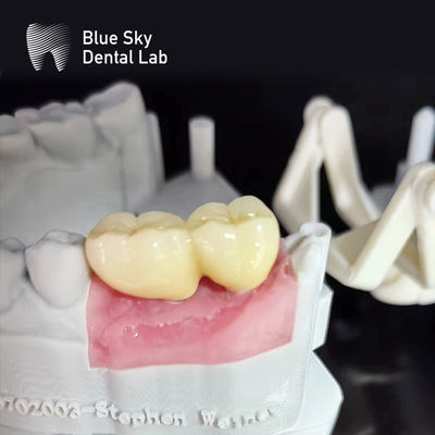 kopen Glanzige oppervlakte Implantaten Dozen Stoomsterilisatie Tandheelkundige Implantaten Dozen online manufacture