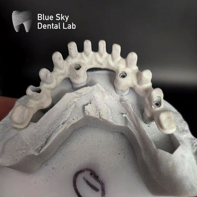kopen Pure Titanium Frame Malo Bridge Aanpasbaar Blauwe Hemel Implantat online manufacture