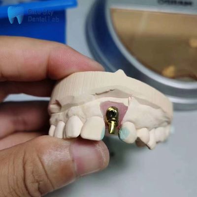kopen Standaard Implantat Hoesjes Aanpasbare enkelvoudige Implantat Tand Offset Arch Implantat Hoesje online manufacture