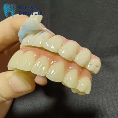 kopen Implantatiekast Artificiële implantatiekast voor naadloze systeemcompatibiliteit online manufacture