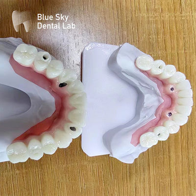 kopen Tandheelkundige multi-implantat hoesjes Op maat gemaakte implantatprocedure hoesjes online manufacture