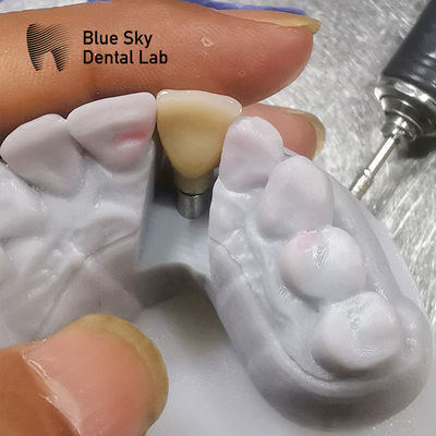 kopen Biocompatibiliteitsonderzoeken Implantatiescenario's Stoomsterilisatie online manufacture