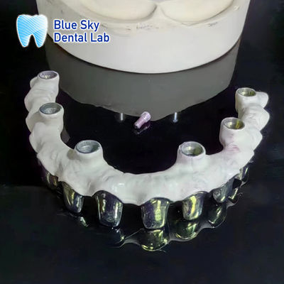 kopen Pure Titanium Malo Bridge Aanpasbare Zilveren Metalen Tanden online manufacture