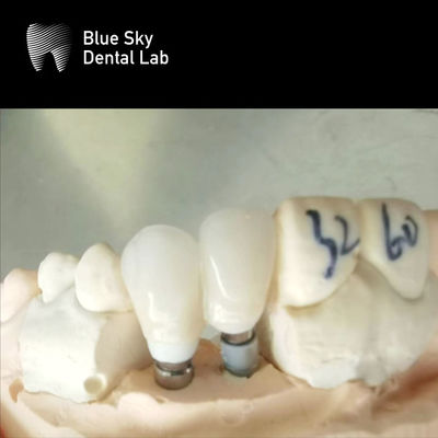 kopen Eenvoudige kronen Zirconia Abutment Hypoallergeen tandheelkundig implantaat Zirconia Abutment online manufacture