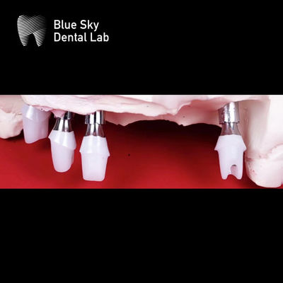 kopen Blauwe hemel tandheelkundige implantaten Zirconia-abutment nauwkeurig gefreesd online manufacture