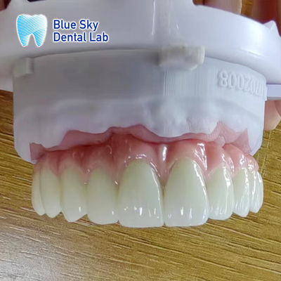 kopen Metalen frame Titanium Malo Bridge Aanpasbare Malo Implant Bridge online manufacture