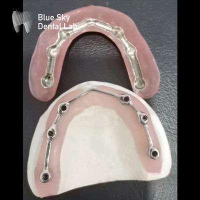 kopen Titaniumbalk voor tandheelkundige implantaten met acrylprothese online manufacture