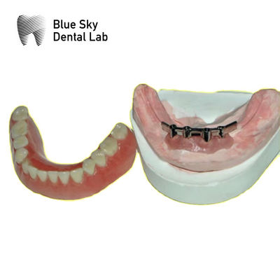 kopen Verwijderbare tandheelkundige titaniumbalk voor tandheelkundige prothesen Blue Sky online manufacture