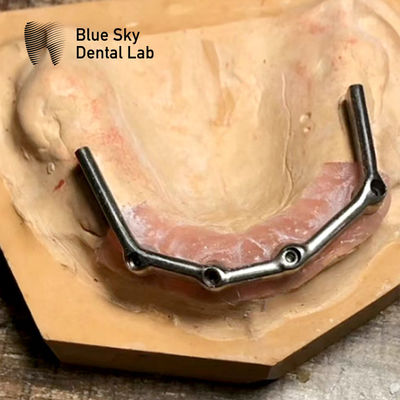 kopen Volledige bovenste tandheelkundige titaniumbalk Volledige mondherstel Blauwe hemel implantaat online manufacture
