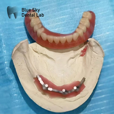 kopen Blue Sky Implantat Titanium Bar Tandheelkunde Voor Implantaten online manufacture
