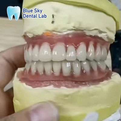 kopen Volledige bovenste en onderste titaniumbalk Blauwe hemel tandheelkundige implantaten online manufacture