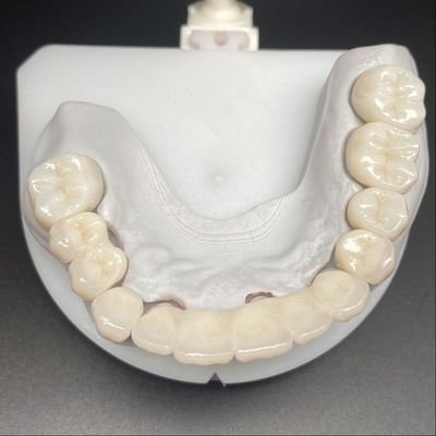 kopen Gelaagde Zirconia Cases met voor vaste restauratie Cases mooie glimlachen Professionele stabiele online manufacture