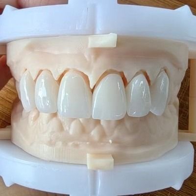 kopen Natuurlijke esthetiek gelaagde Zirconia Crown Bridge voor een mooie glimlach en goede restauratie FDA en CE-certificering online manufacture