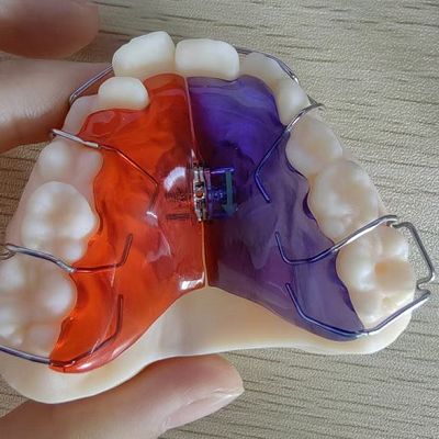 kopen Scenario's voor gladde kunststof implantatie voor op maat gemaakte oplossingen online manufacture