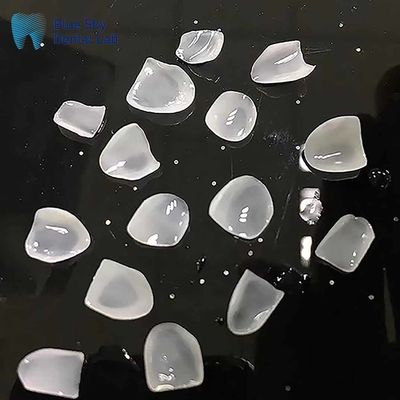 Ultrathin E Max veneers Ingot klasse Keramische natuurlijke veneers