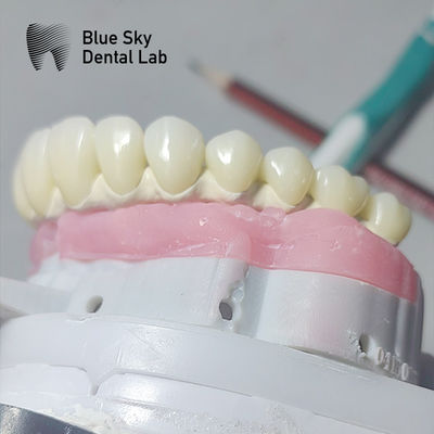 Puur Titanium Malo Implant Bridge Universele Metalen Frame Malo Bridge
