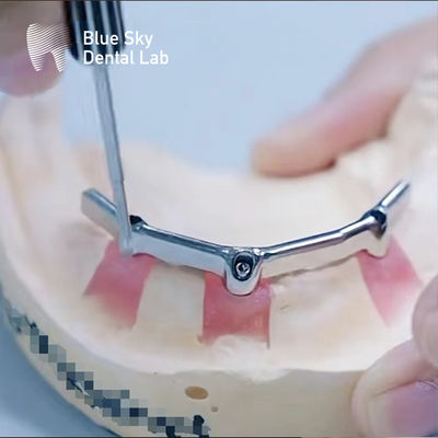 Precieze tandheelkundige titanium staaf met kostbare aanhangsel Biocompatibel