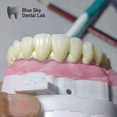 Universele tandheelkundige implantathoes compatibel met meerdere implantatsystemen