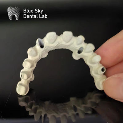Titanium Frame Malo Bridge Dental Custom Malo Implant Bridge