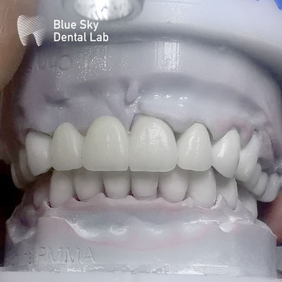 Rectangulaire gelaagde zirconia tanden meerlagig voor glas