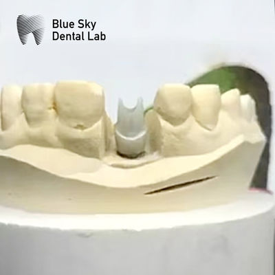Aesthetisch Zirconia-implantat Biocompatibel Precision Milled