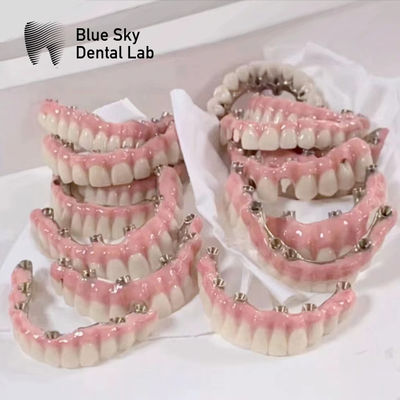 Blue Sky Implantat Hoesjes Met Malo Frame Bridge Puur Titanium