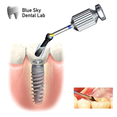 Interne hex-ASC-abutment Verstelbare hoekige schroefkanaal-abutment