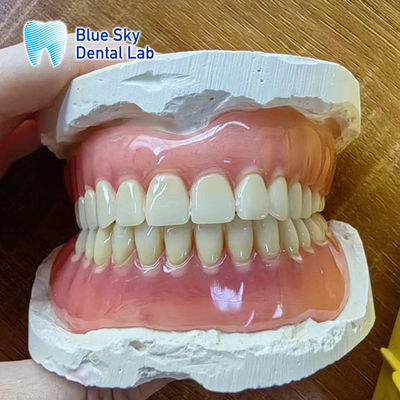 Ontbrekende tanden Acrylische volledige tandheelkundige restauratie Acrylische volledige tandheelkundige