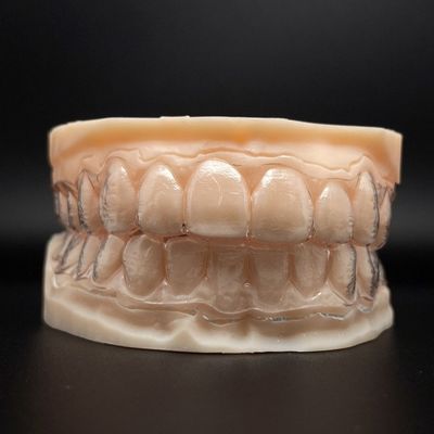 Aanpasbare tanden, onzichtbare aligners, heldere beugels en kortere behandeltijd