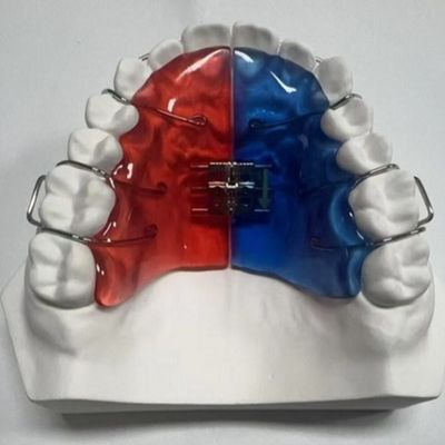 Roestvrij staal acryl schroef expander orthodontische behandeling verwijderbaar